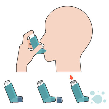 Признаки бронхиальной астмы у взрослых