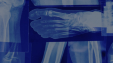 Лучевая диагностика травматических изменений костно-суставного аппарата