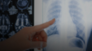 Лучевая диагностика в интенсивной терапии: чем может помочь рентгенолог?