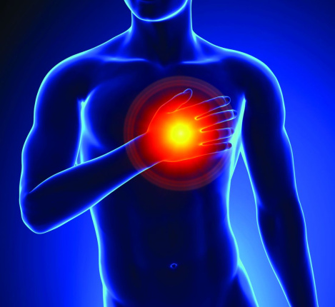 Причины развития инфаркта миокарда